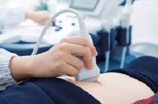 نوبت دهی سونوگرافی علیرضا پرویز