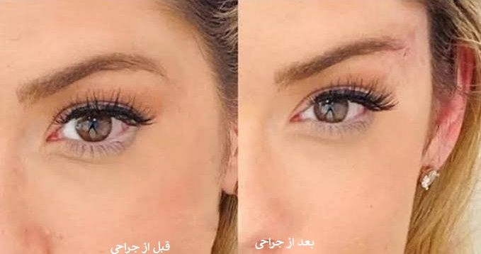 دکتر صابر (جراحی بلفاروپلاستی پلک فوقانی) با 20% تخفیف 16 میلیون تومان