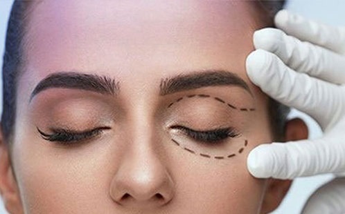 بلفاروپلاستی در تبریز؛ راهنمای جامع جراحی زیبایی پلک