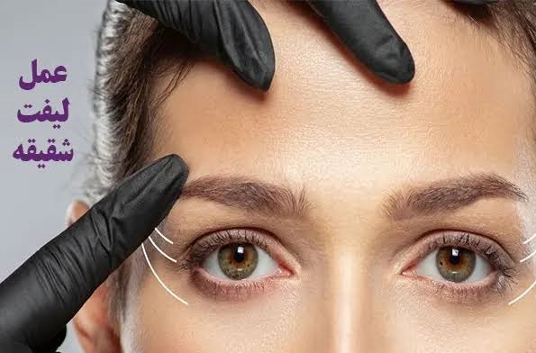 بهترین پزشکان متخصص جراحی لیفت شقیقه در تبریز